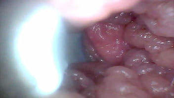 Endoscope camera shows the most sensitive parts of the penis