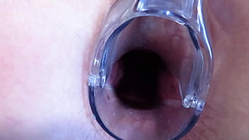 Stretching the anal and vagina with a gynecological speculum. MILF