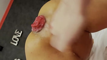 Monika Fox Is Prolapse Queen! The Most Beautiful Roses 2022!