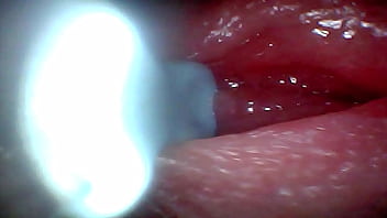 Endoscope camera captures moment of male ejaculation