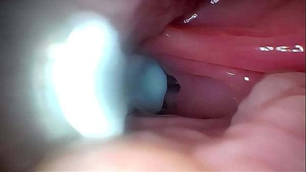 Semen in Cervix Wide Stretching Pussy Endoscope!